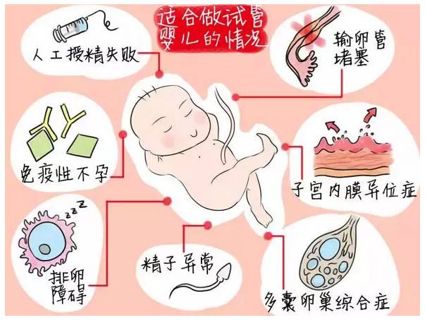 美中宜和问诊室第八期：左文莉教授揭秘试管婴儿